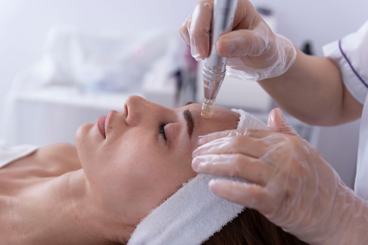 does ghk cu clear acne PDF] Copper Peptides in Acne Scars